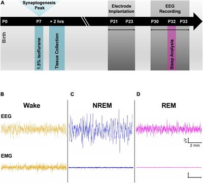 Neonatal Isoflurane Does Not Affect Sleep Architecture and Minimally Alters Neuronal Beta Oscillations in Adolescent Rats